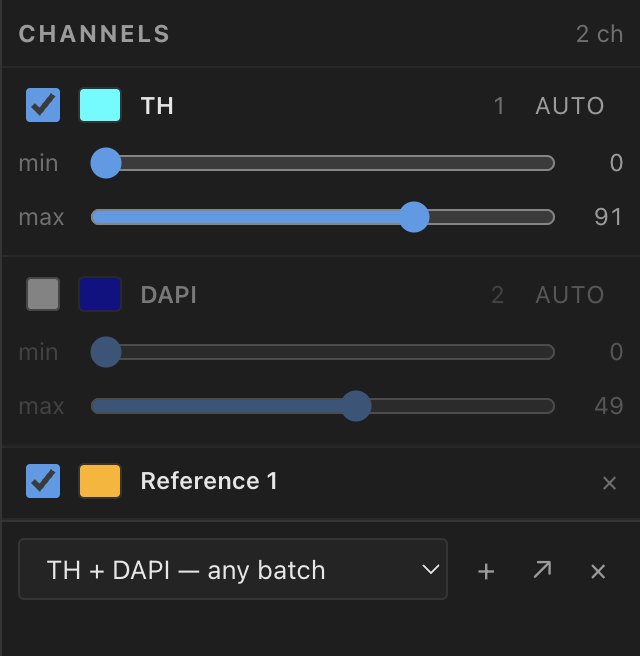 The Channels panel on TH bregma -3.64: TH in cyan from 0 to 91, DAPI hidden, the outline Reference 1, and the preset TH + DAPI