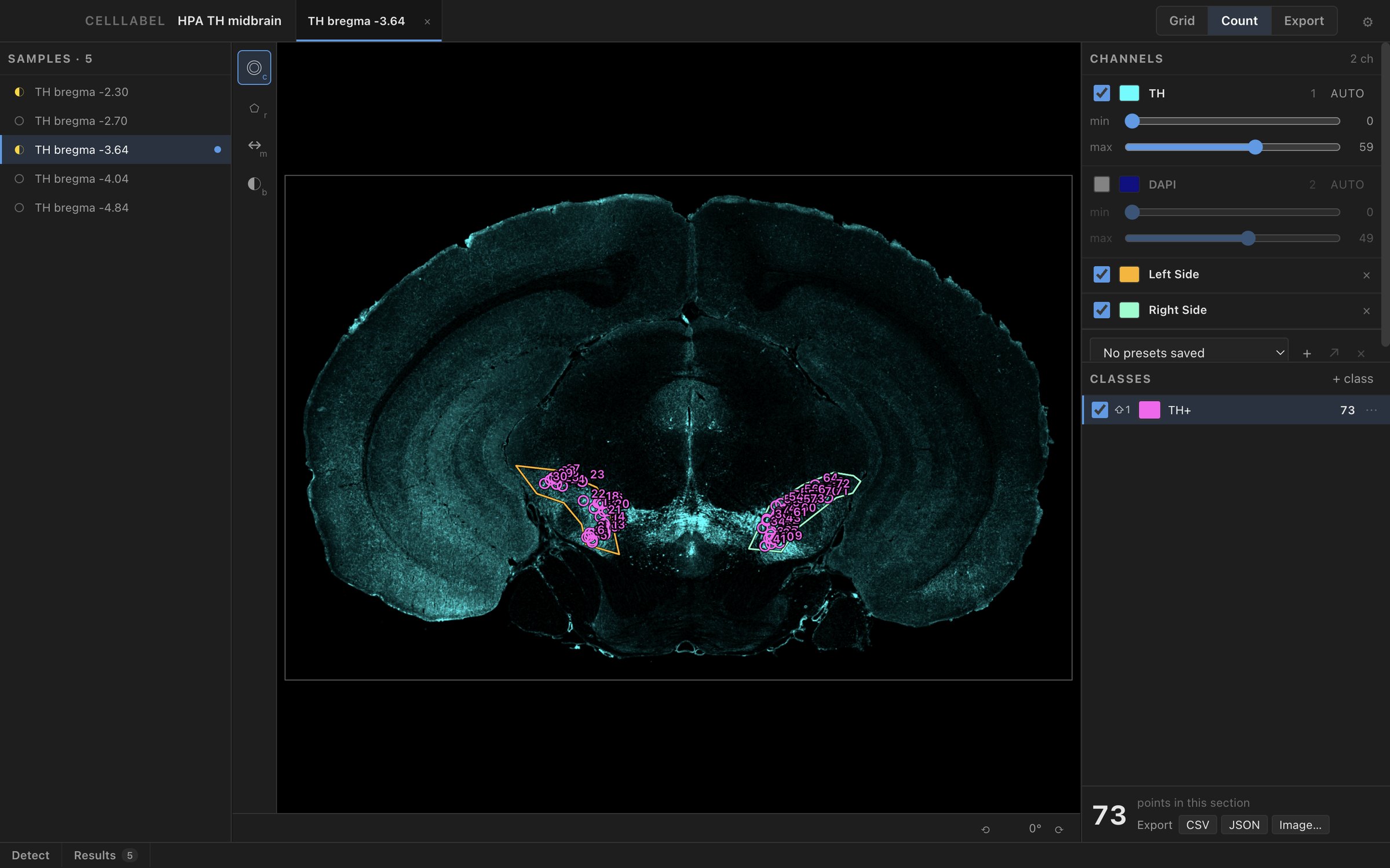 CellLabel on a mouse midbrain section stained for TH: the samples list, the whole section with outlines around the left and right SNc and 73 TH+ points inside them, and the channel and class settings