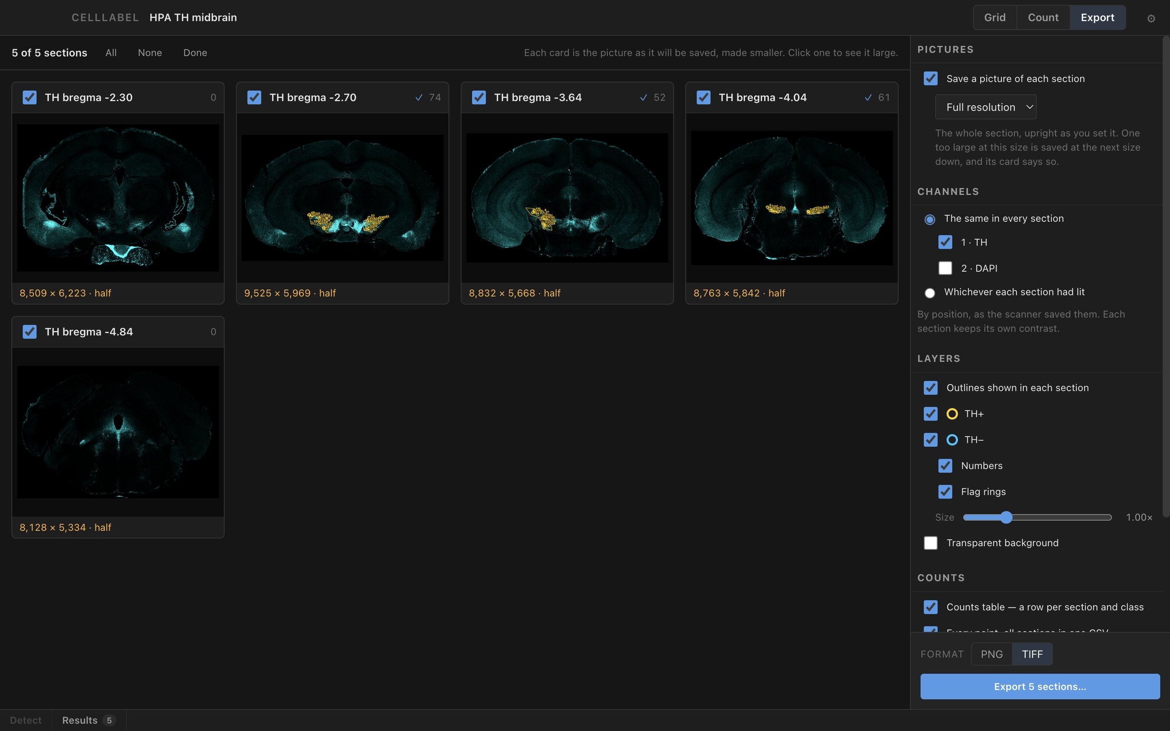 The Export view: a preview card for each of the 5 sections, and the settings for pictures, channels, layers and format