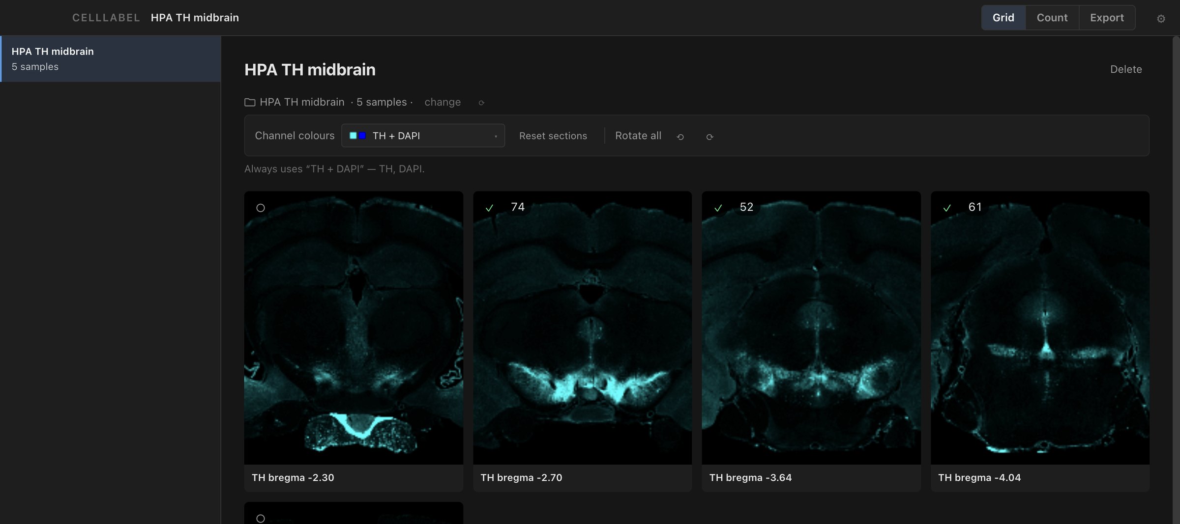 The Grid view for the project HPA TH midbrain: five sections stained for TH, three ticked off with 74, 52 and 61 points